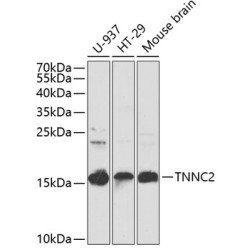 TNNC2 Rabbit pAb