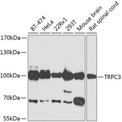 TRPC3 Rabbit pAb