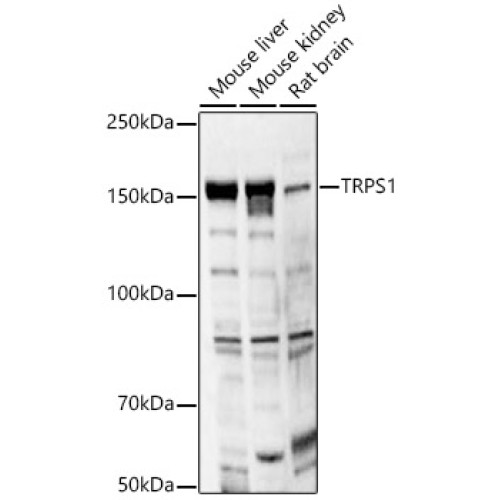 TRPS1 Rabbit pAb