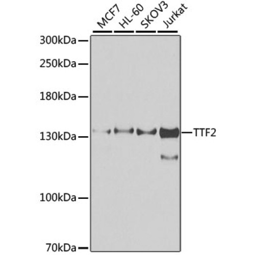 TTF2 Rabbit pAb
