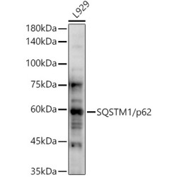 SQSTM1/p62 Rabbit pAb