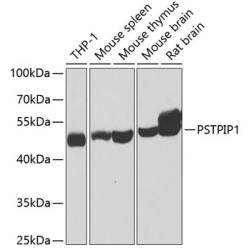 PSTPIP1 Rabbit pAb