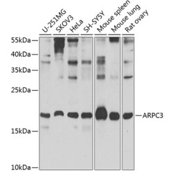 ARPC3 Rabbit pAb
