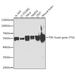 TRK fused gene (TFG) Rabbit pAb