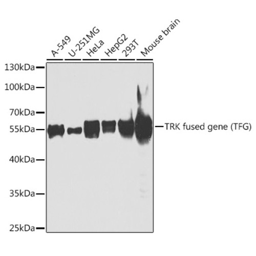 TRK fused gene (TFG) Rabbit pAb