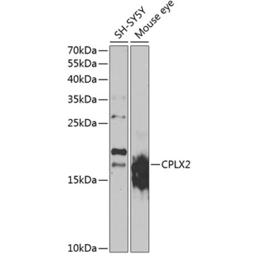 CPLX2 Rabbit pAb