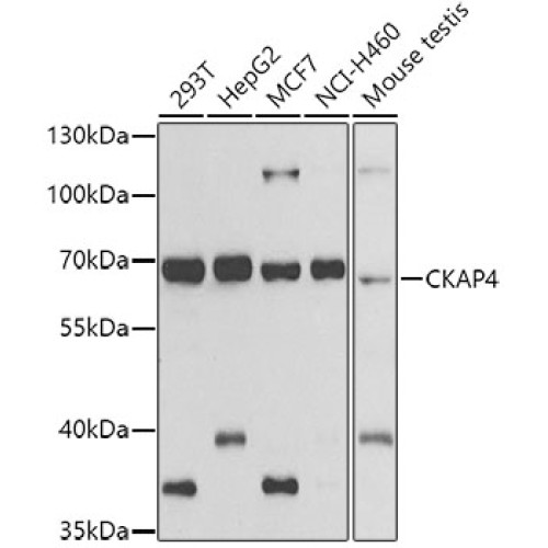 CKAP4 Rabbit pAb