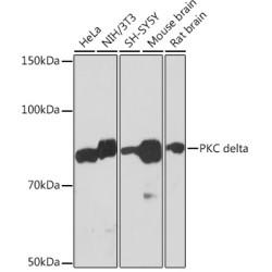 PKC delta Rabbit mAb
