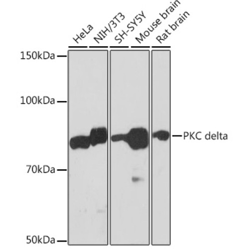 PKC delta Rabbit mAb