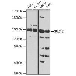 [KO Validated] SUZ12 Rabbit pAb