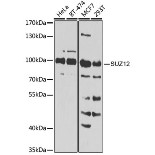 [KO Validated] SUZ12 Rabbit pAb
