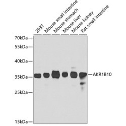 AKR1B10 Rabbit pAb