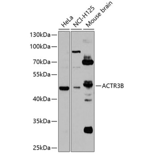 ACTR3B Rabbit pAb