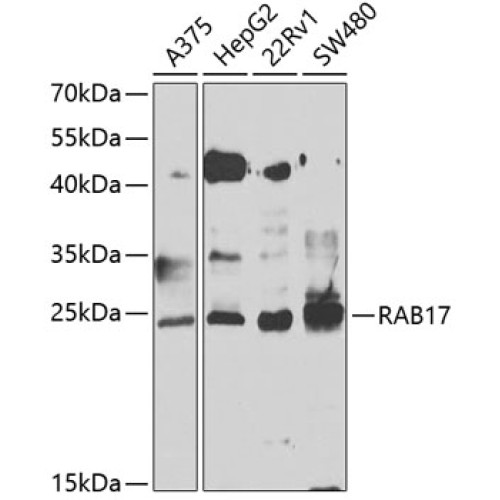 RAB17 Rabbit pAb