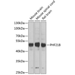 PHF21B Rabbit pAb