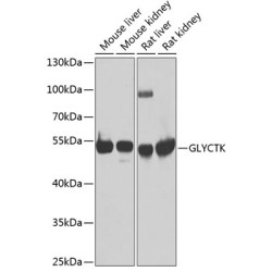 GLYCTK Rabbit pAb