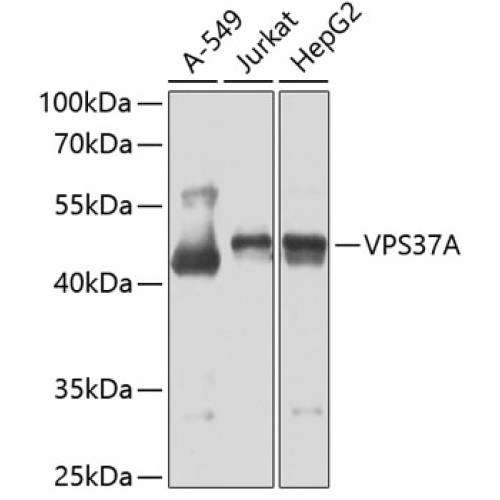 VPS37A Rabbit pAb