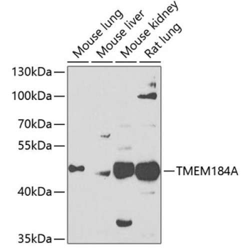 TMEM184A Rabbit pAb