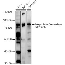 Proprotein Convertase 9(PCSK9) Rabbit pAb