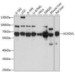 ACADVL Rabbit pAb