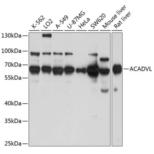 ACADVL Rabbit pAb