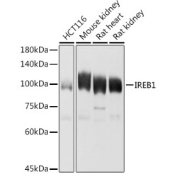 Aconitase 1 (ACO1) Rabbit pAb