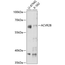 ACVR2B Rabbit pAb