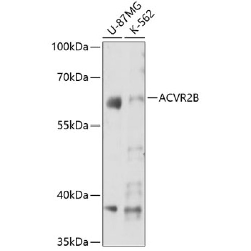 ACVR2B Rabbit pAb
