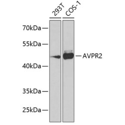 AVPR2 Rabbit pAb