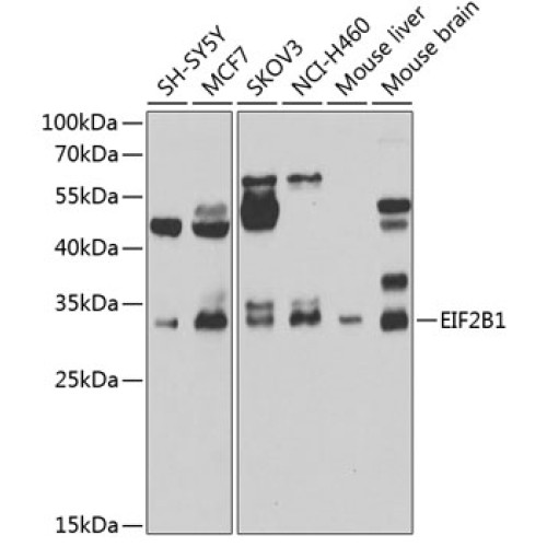 EIF2B1 Rabbit pAb