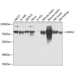 HSPA2 Rabbit pAb