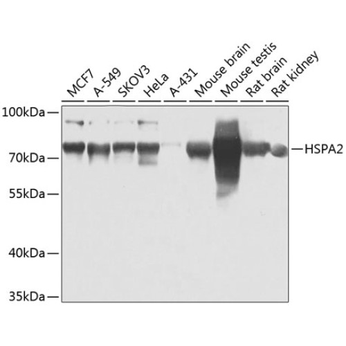 HSPA2 Rabbit pAb