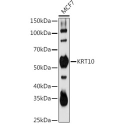 KRT10 Rabbit pAb