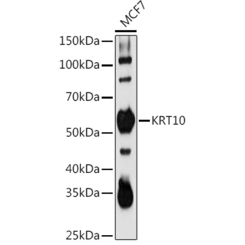 KRT10 Rabbit pAb
