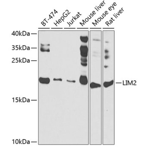 LIM2 Rabbit pAb