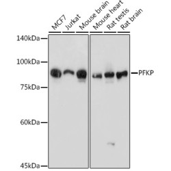 PFKP Rabbit pAb