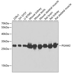 PGAM2 Rabbit pAb