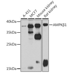 AMPKβ1 Rabbit pAb