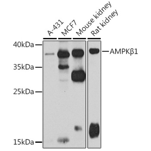 AMPKβ1 Rabbit pAb