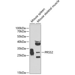 PRSS2 Rabbit pAb