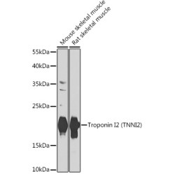 Troponin I2 (TNNI2) Rabbit pAb