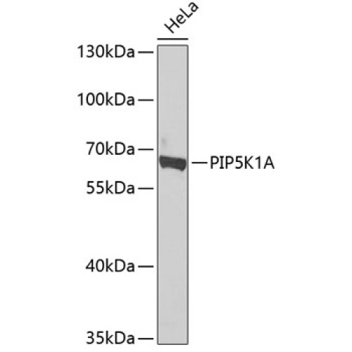 PIP5K1A Rabbit pAb