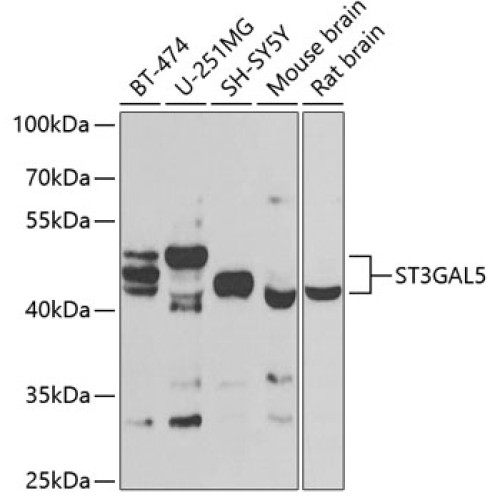 ST3GAL5 Rabbit pAb