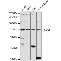 SOCS5 Rabbit pAb