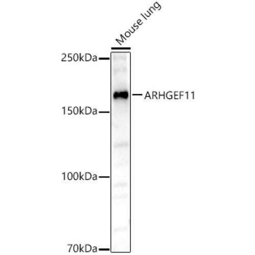 ARHGEF11 Rabbit pAb