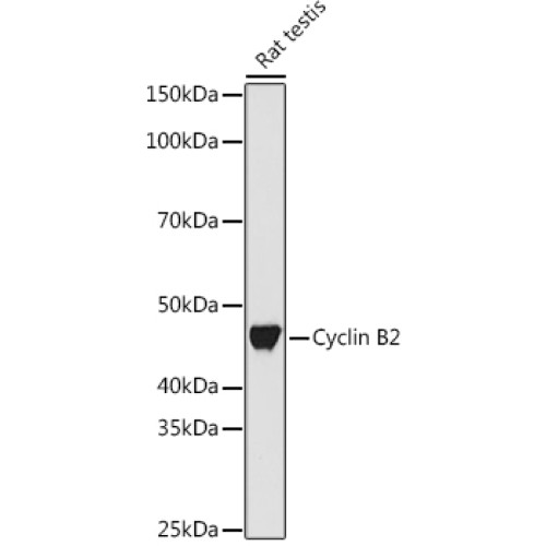 Cyclin B2 Rabbit mAb