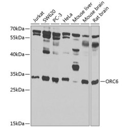 ORC6 Rabbit pAb
