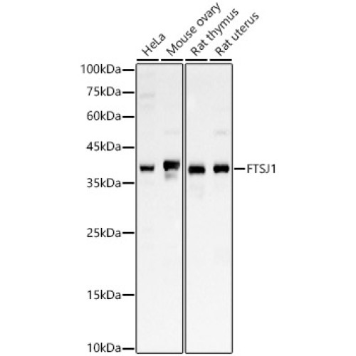 FTSJ1 Rabbit pAb