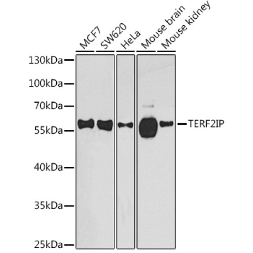 TERF2IP Rabbit pAb