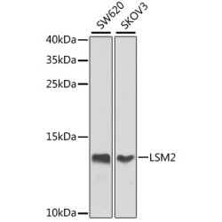 LSM2 Rabbit pAb